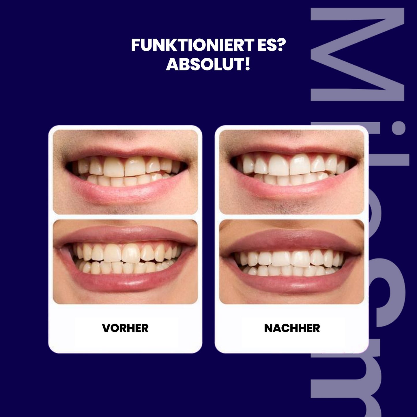 MiloSmile PureWhite Streifen